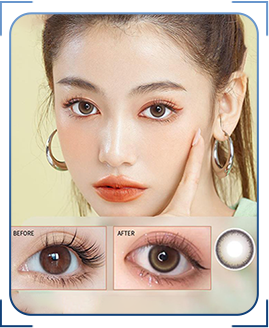 Kinh doanh lens mera